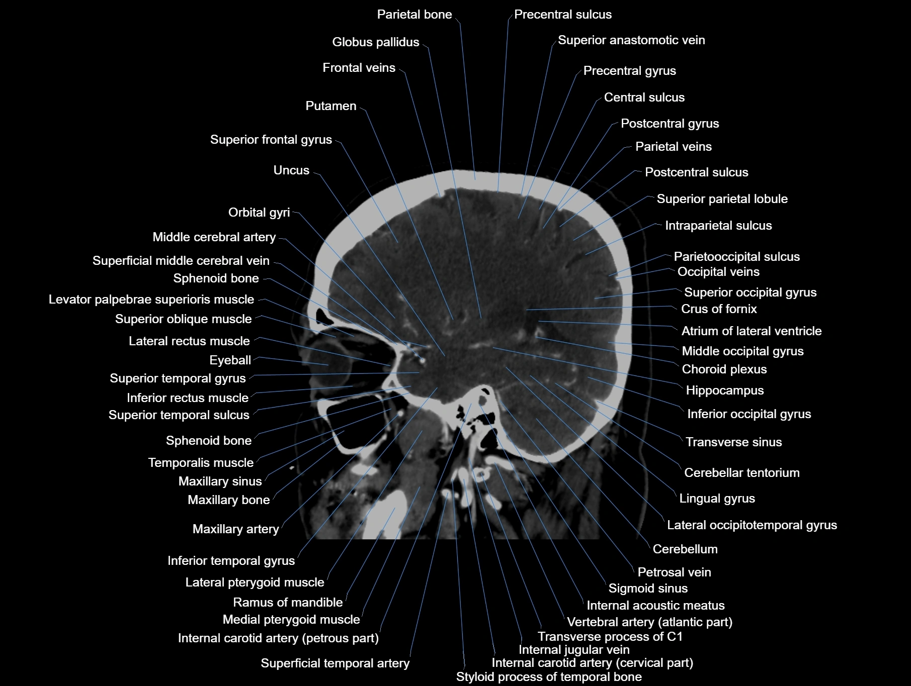 CT scan brain sagittal cross sectional anatomy image-img-00001-00025.webp